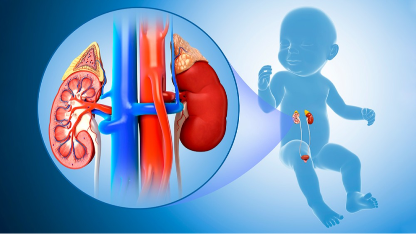 Urological Conditions in Babies