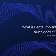 What is Dental Implants and How much does it Cost in UK?