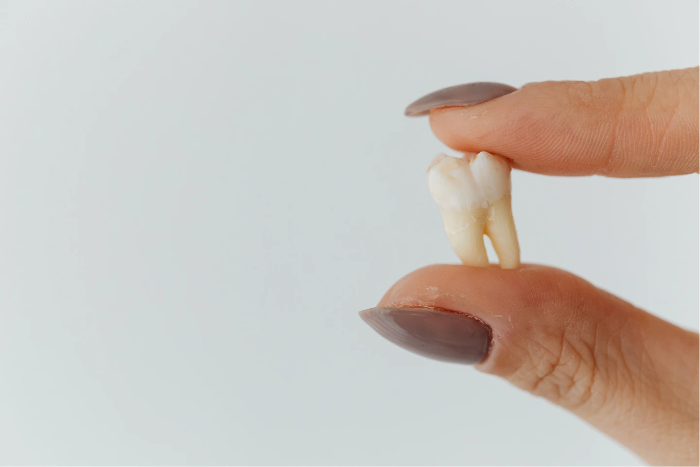 Root Canal vs Tooth Extraction
