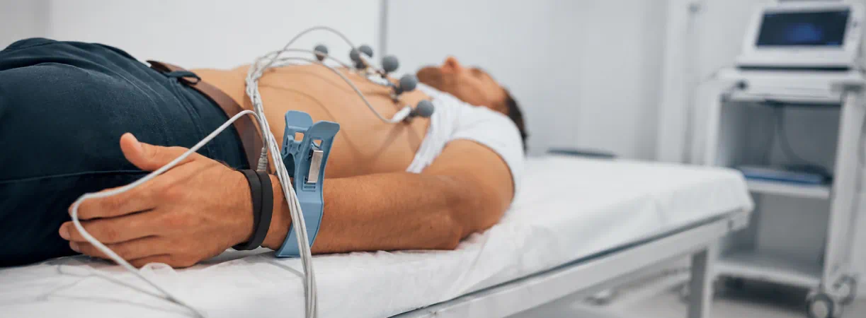 ECG