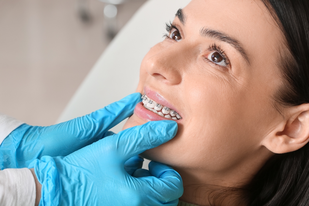 Braces for Adults: Is It Ever Too Late to Straighten Your Teeth? | Parkway Smiles Dentistry