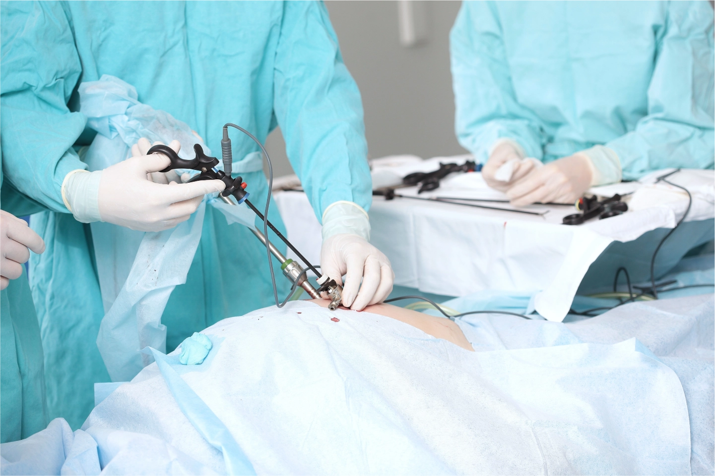 Laproscopy Surgery
