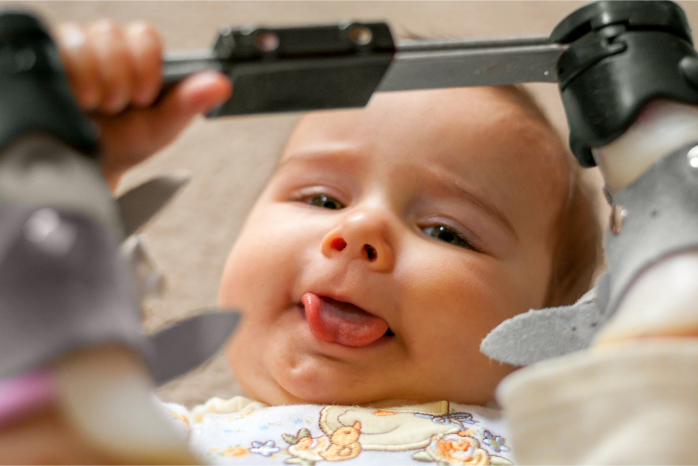laser frenectomy