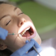 Porcelain Veneers Cost In The UK