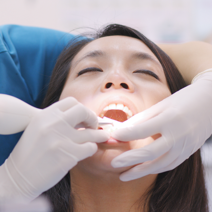 Keep Your Smile Bright with Professional Deep Cleaning in San Jose, CA