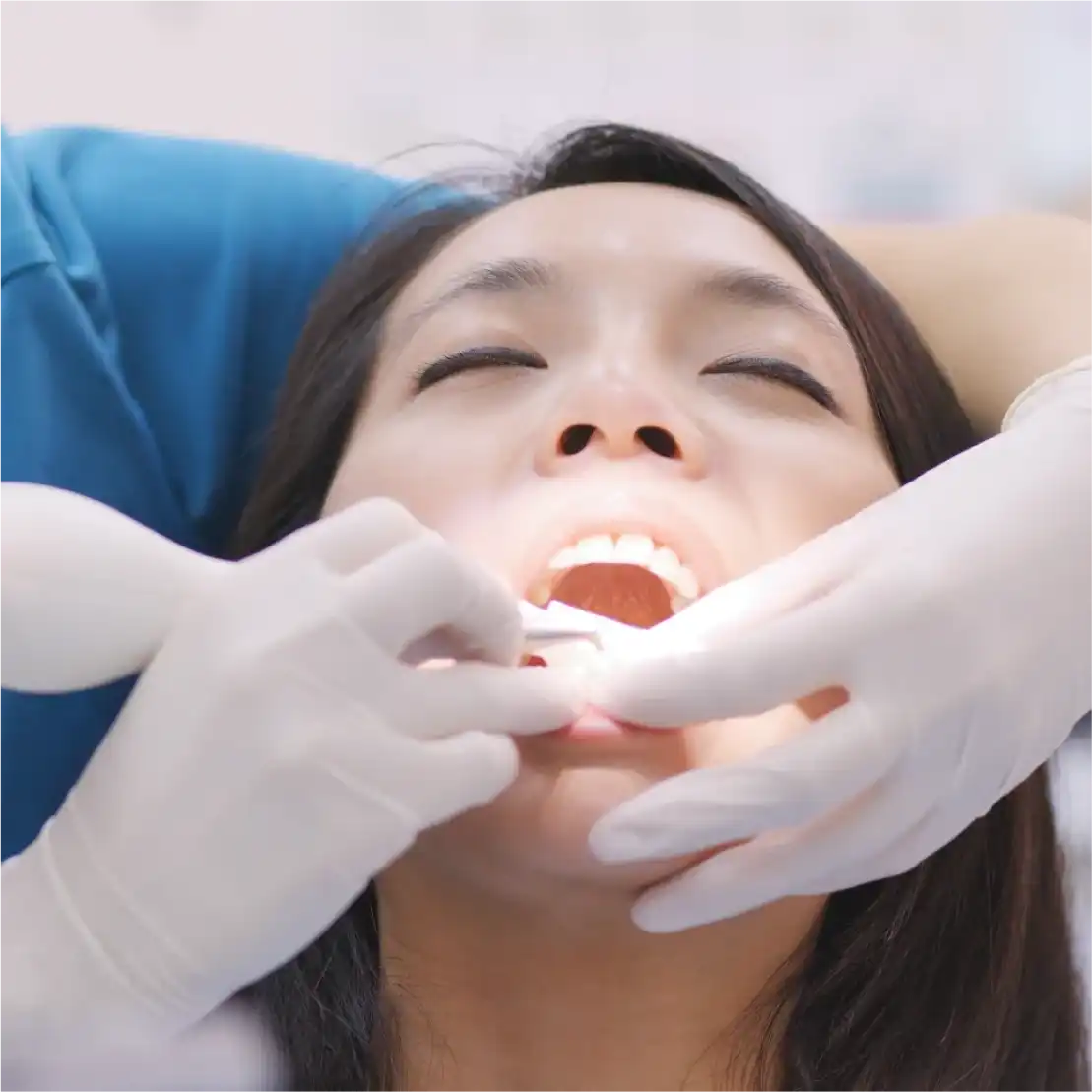 What Is Pocket Reduction Surgery