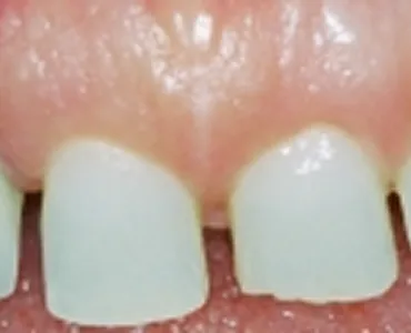 main-image
