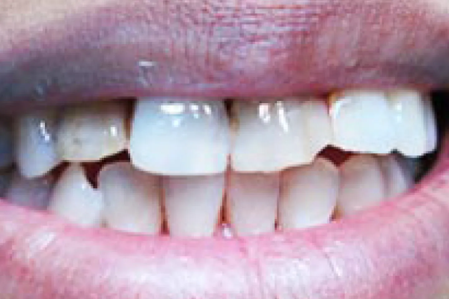 main-image