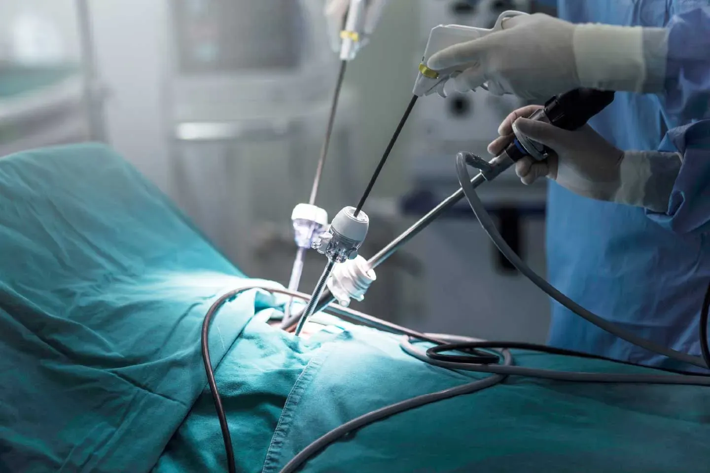 Gynecologic surgeon explaining open and laparoscopic myomectomy options to a woman with uterine fibroids