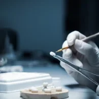 What Is the Difference Between a CEREC and a Crown?