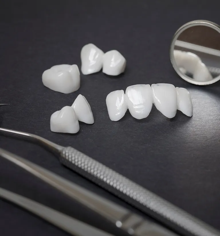 What Are Porcelain Veneers?