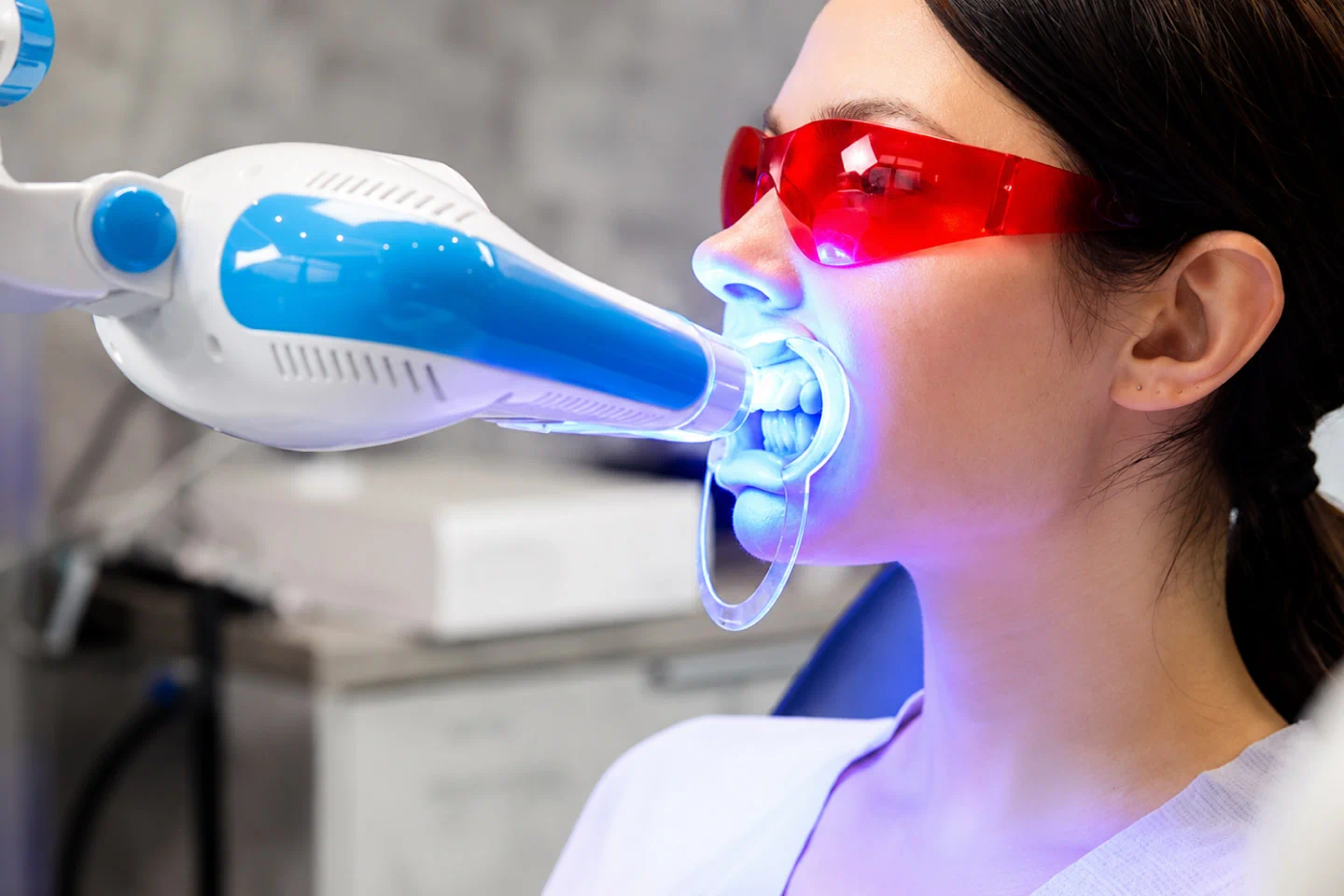 Teeth Whitening