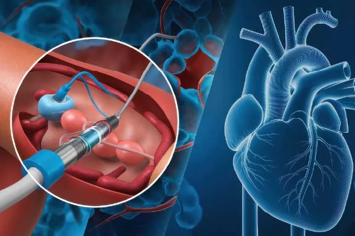 Minimally Invasive Cardiac Surgery
