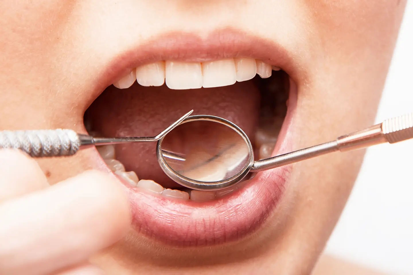 Periodontal Disease Self-Evaluation