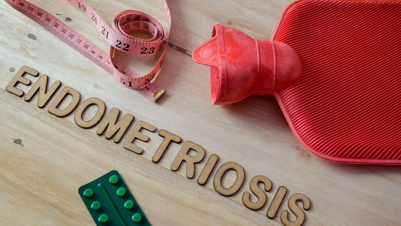 Comparative illustration of ovaries with endometriosis and PCOS symptoms