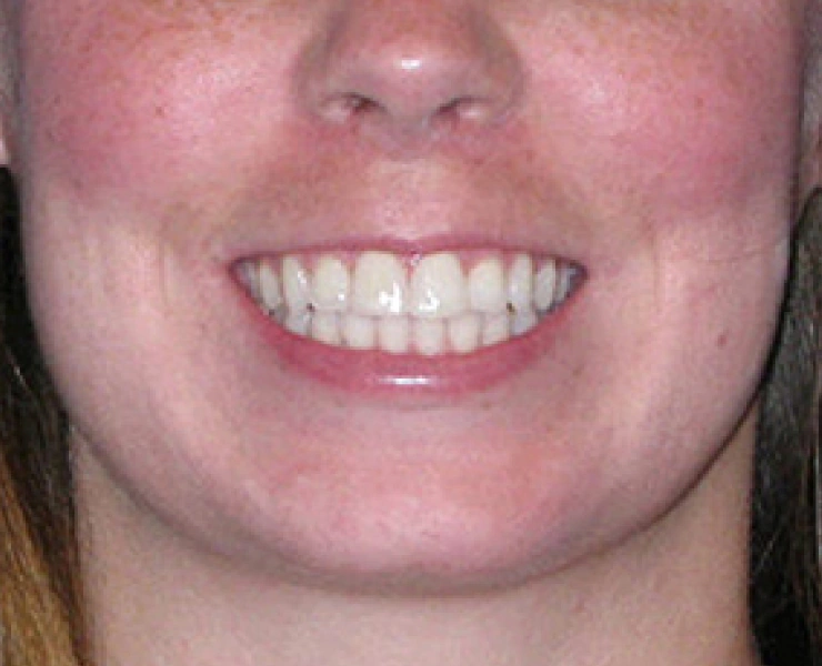main-image
