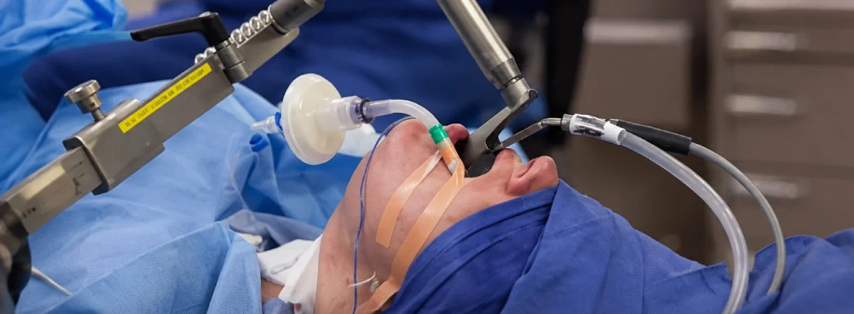 Microlaryngeal Surgery (MLS)