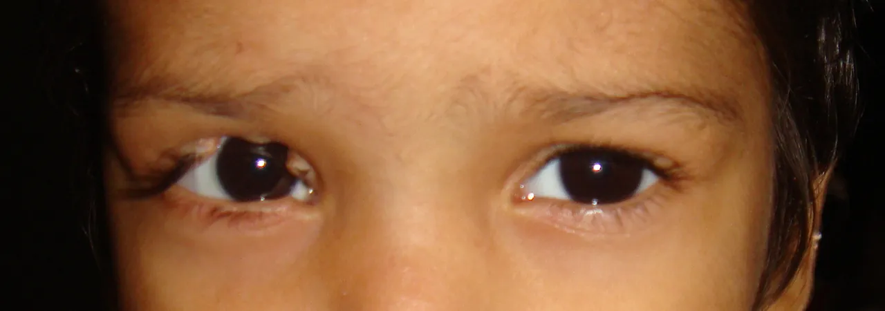blog.image