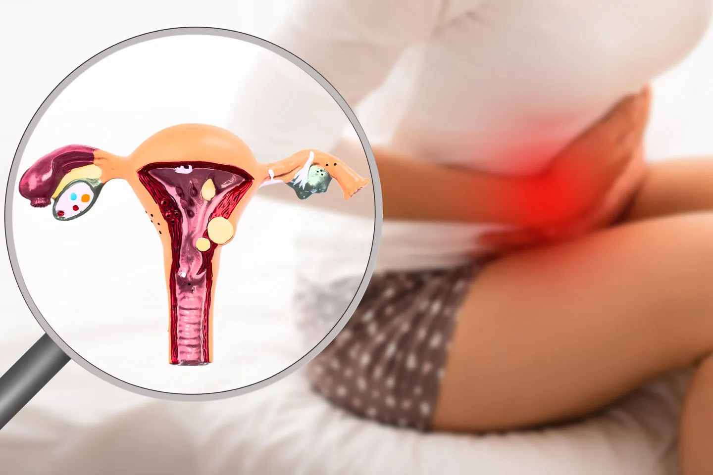 Best Endometriosis treatment with Dr Kiranjeet Kaur