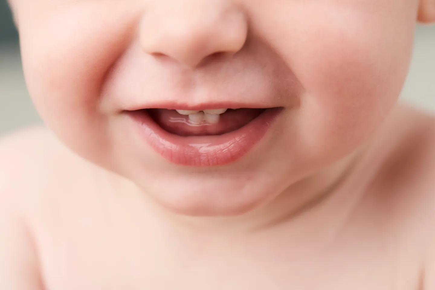 Baby Teeth Falling Out Too Early? Causes & Solutions