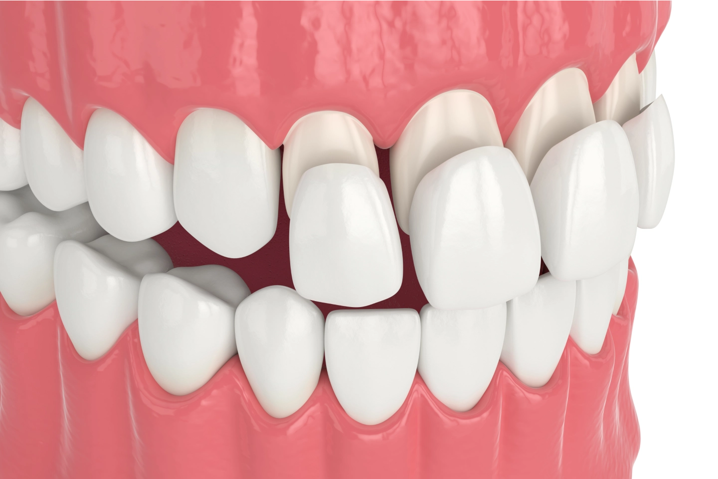 varni dental image