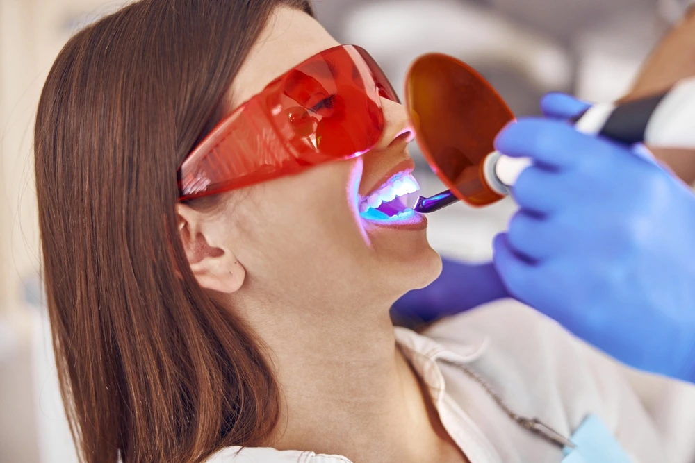 Top Benefits of Laser Dentistry for Gums and Soft Tissues