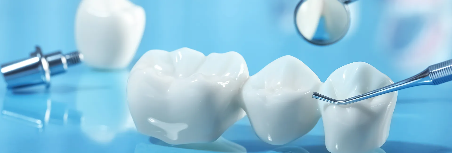 How Much Do Dental Crowns Cost: A Comprehensive Guide
