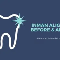Inman Aligner Before & After