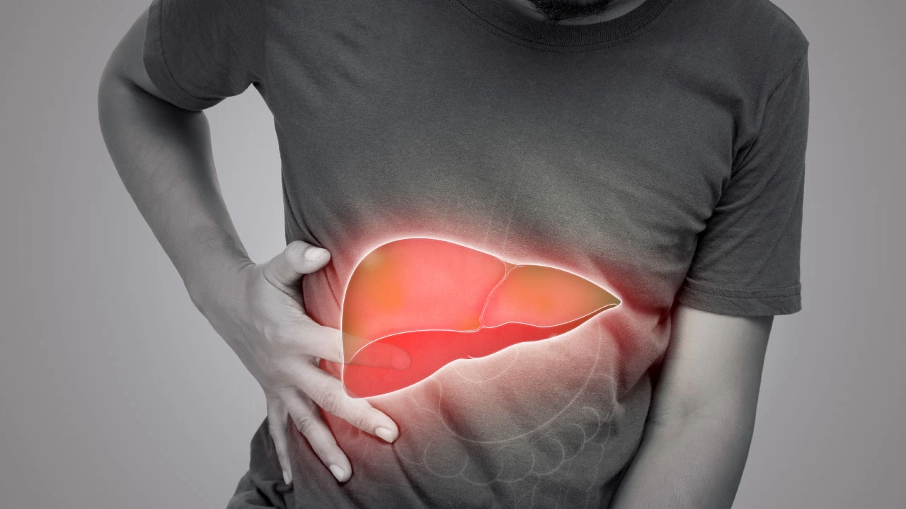 liver cirrhosis medical illustration