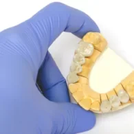 How Much Do Ceramic Fillings Cost in the UK?