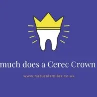 How much does a Cerec Crown cost?