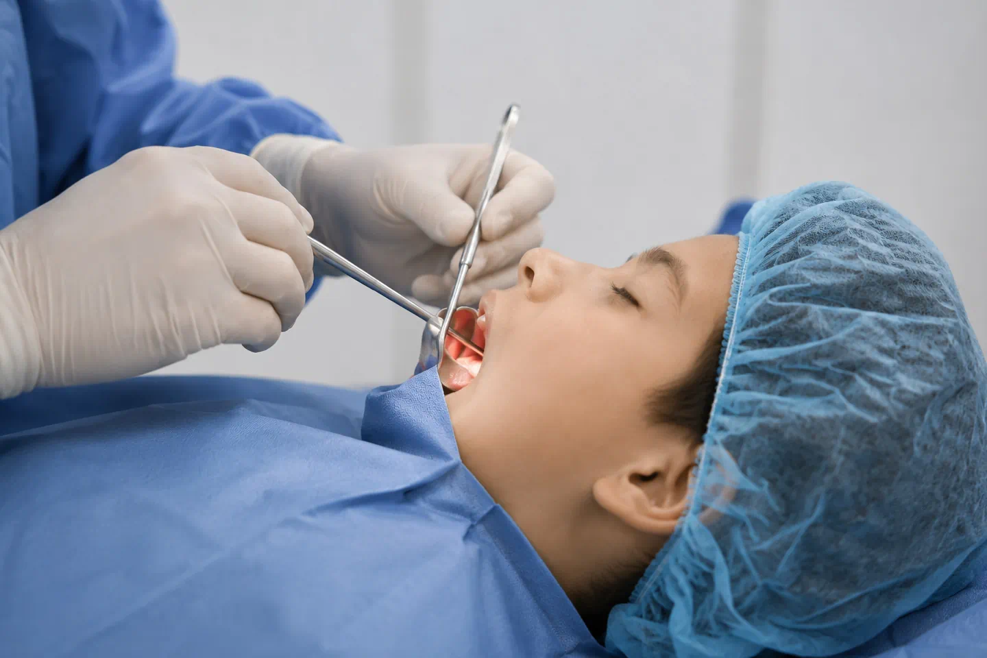 Adenoidectomy