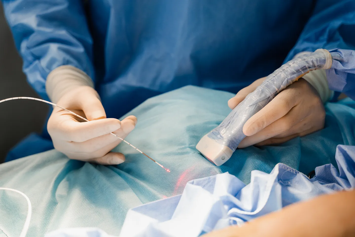 Medical illustration of laser prostate surgery procedure for BPH