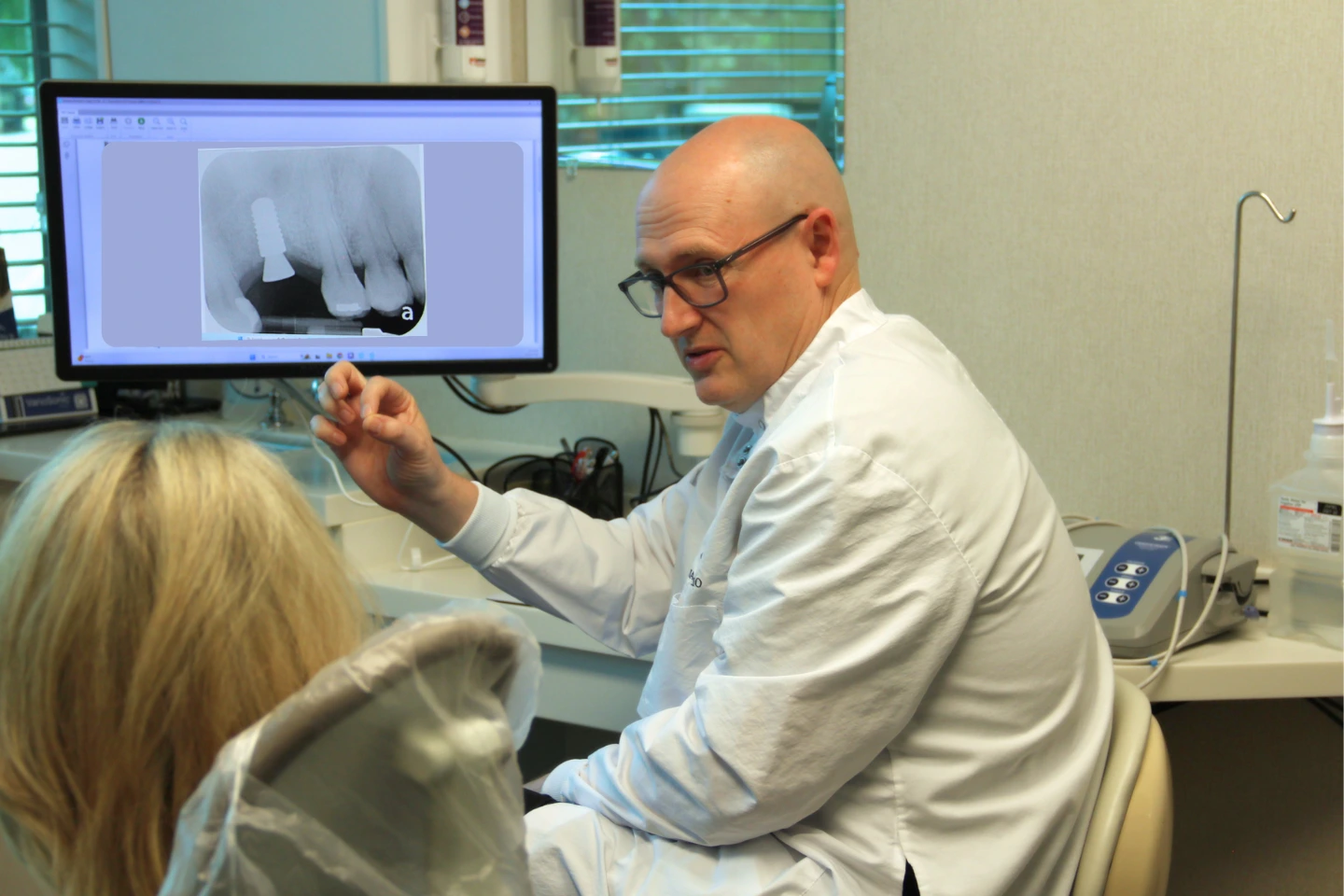 Benefits of Dental Implants Over Other Tooth Replacement Options