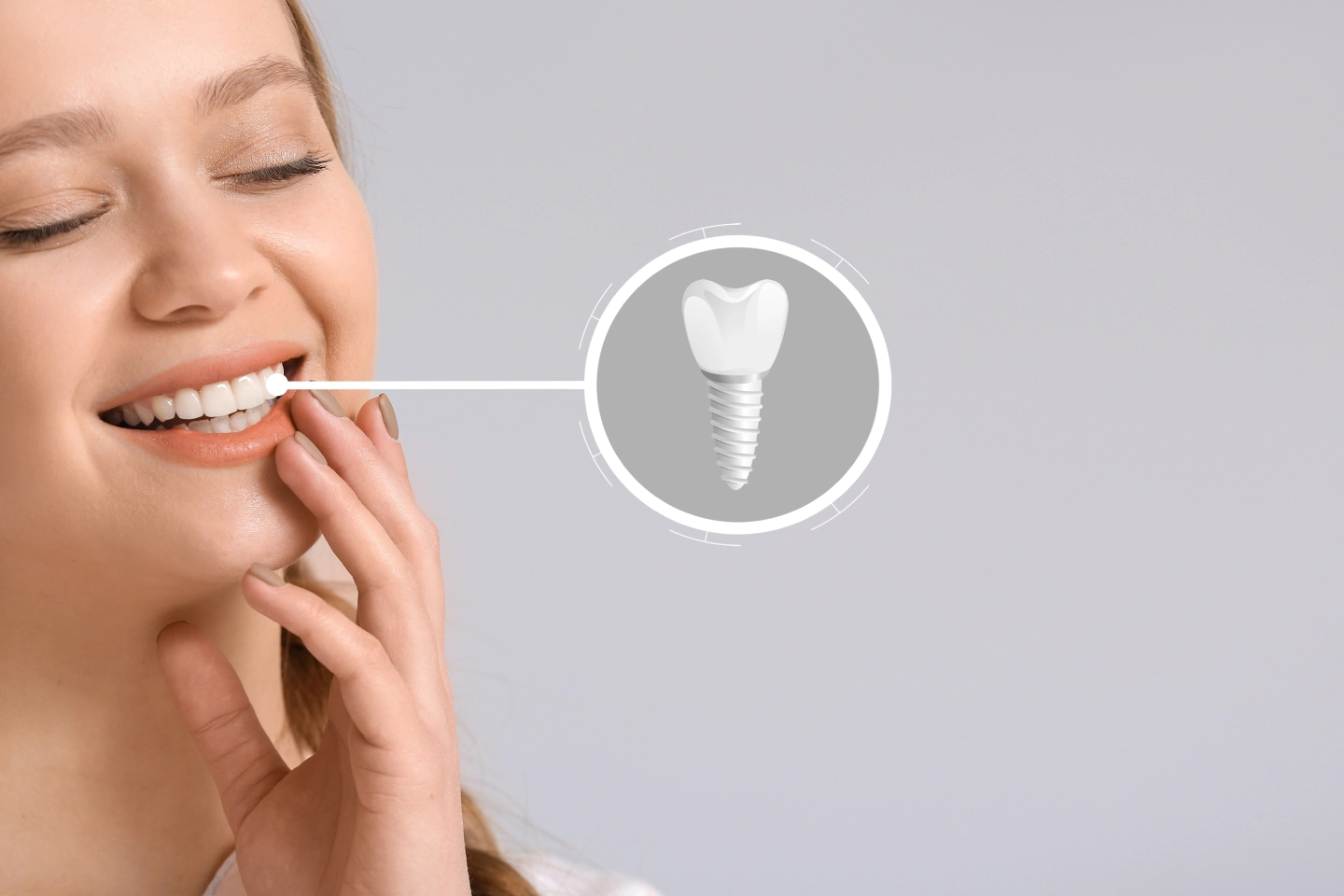 Enhance Your Smile with Dental Implants at Ripon Dental