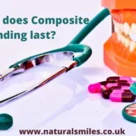 How long does Composite Bonding last?