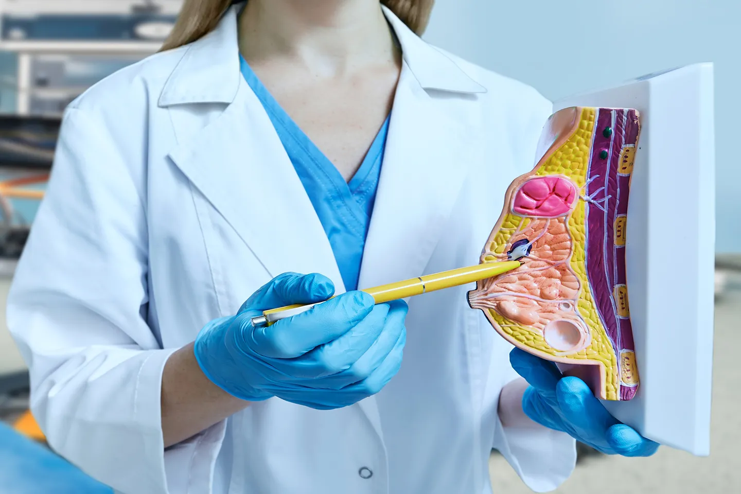 Breast-Conserving Surgery Illustration