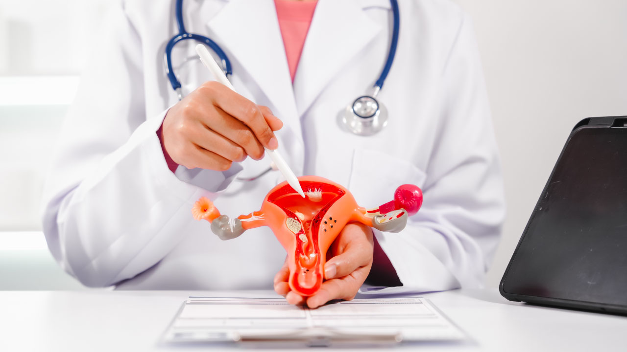 Illustration of a uterus with fibroids and endometriosis spots highlighted
