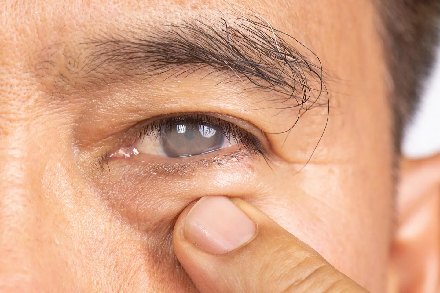 The Sneak Thief of Sight