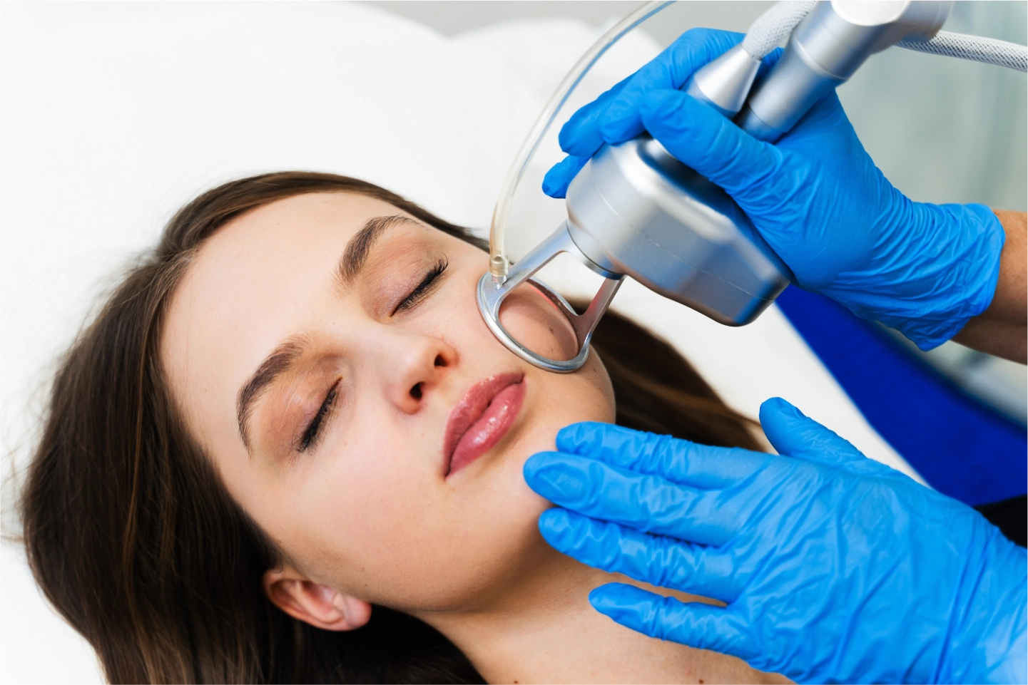 Laser Treatment
