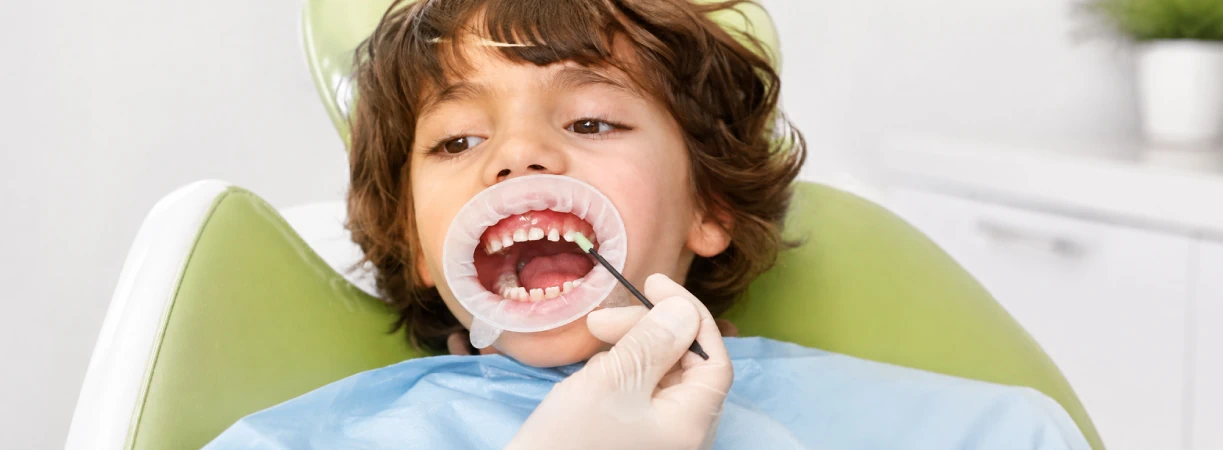 Fluoride treatment