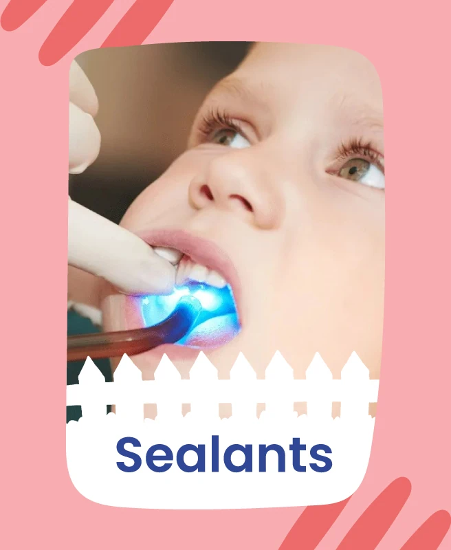 sealants