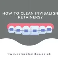 How to Clean Invisalign Retainers?