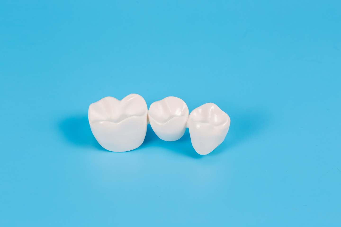 How Long Do Dental Crowns Last?