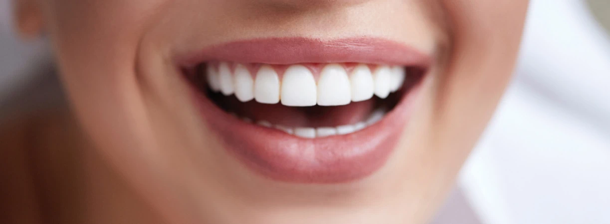 Teeth Whitening