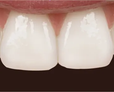 main-image