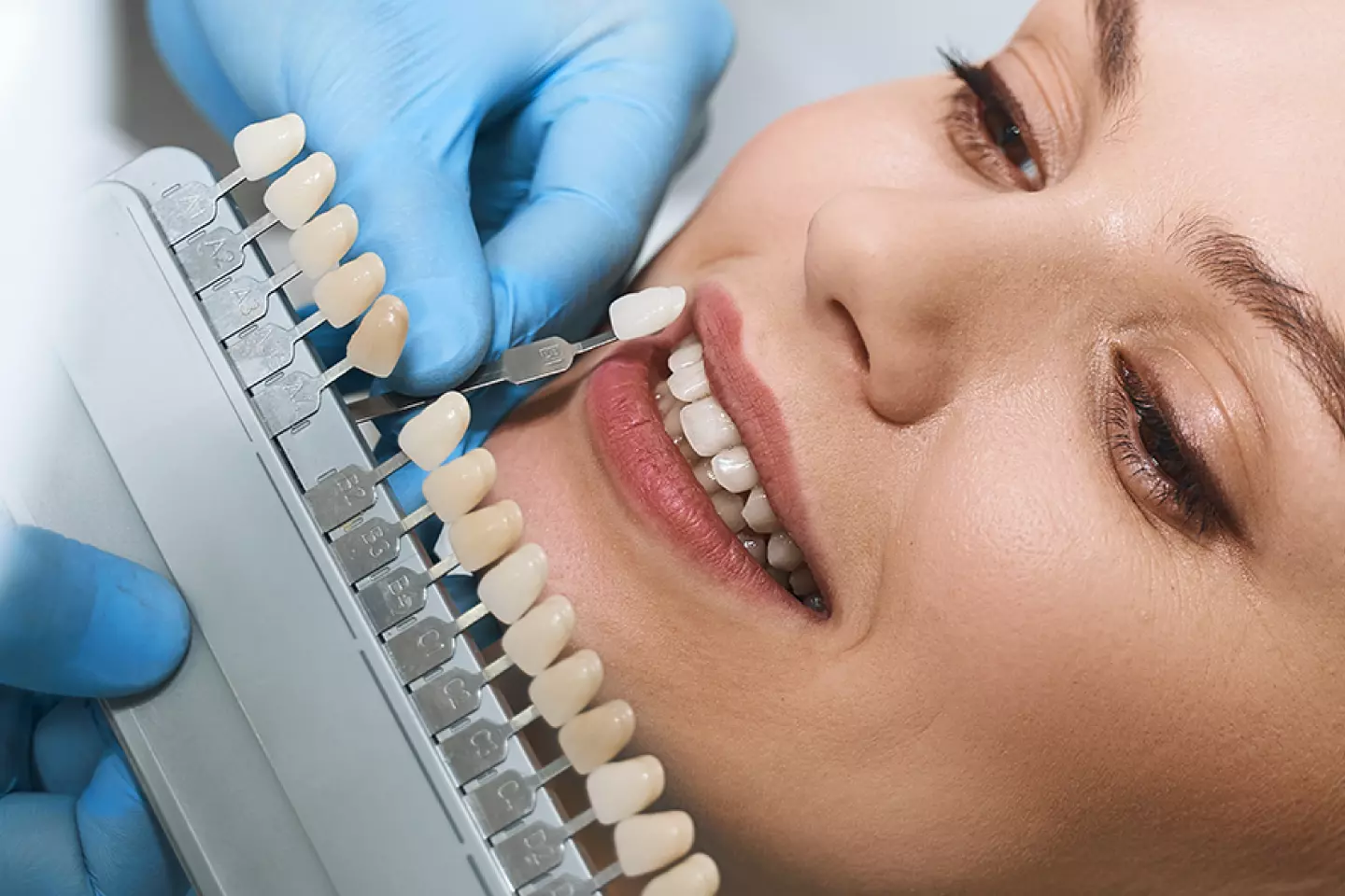 Get Cosmetic Dentistry at Spring Field Dental