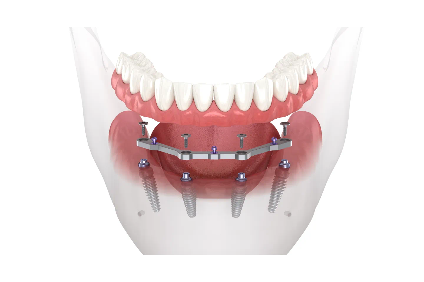 section.image