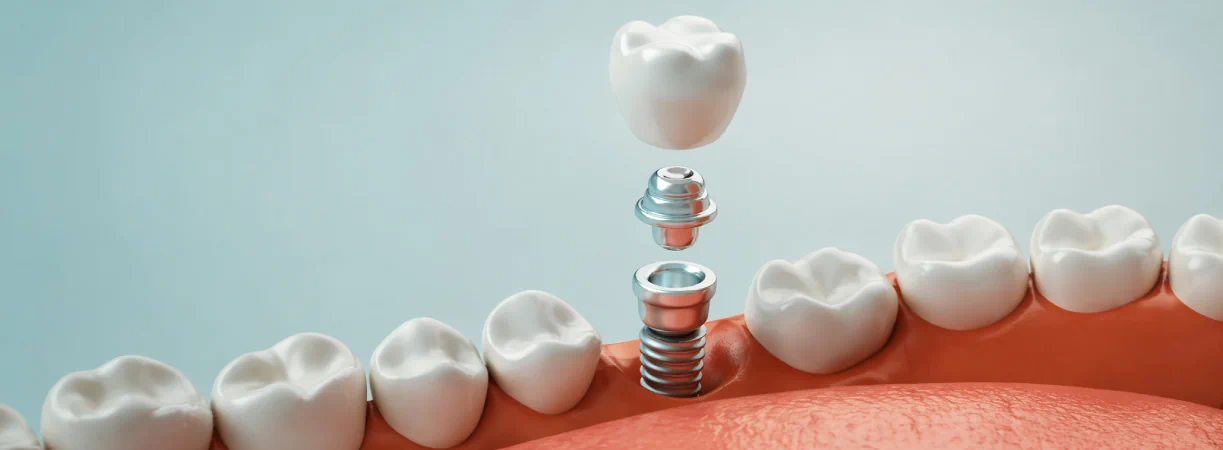 Orthodontic Dentistry in Newton, MA