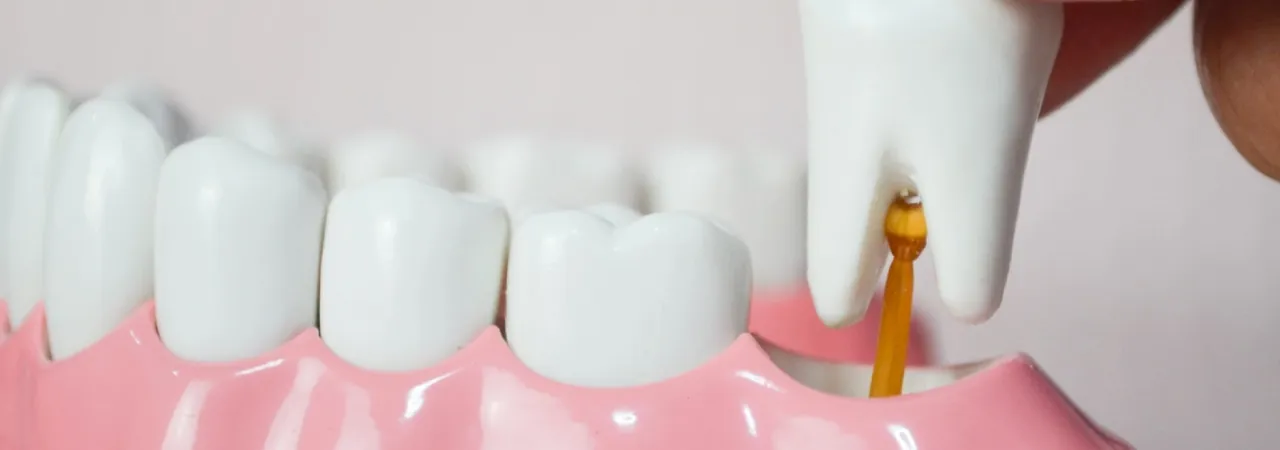 Get to Know Your Wisdom Teeth